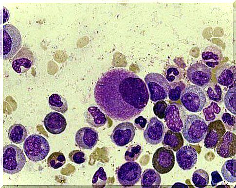 Lymphocytes