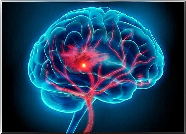 brain representing the inflammatory theory of depression